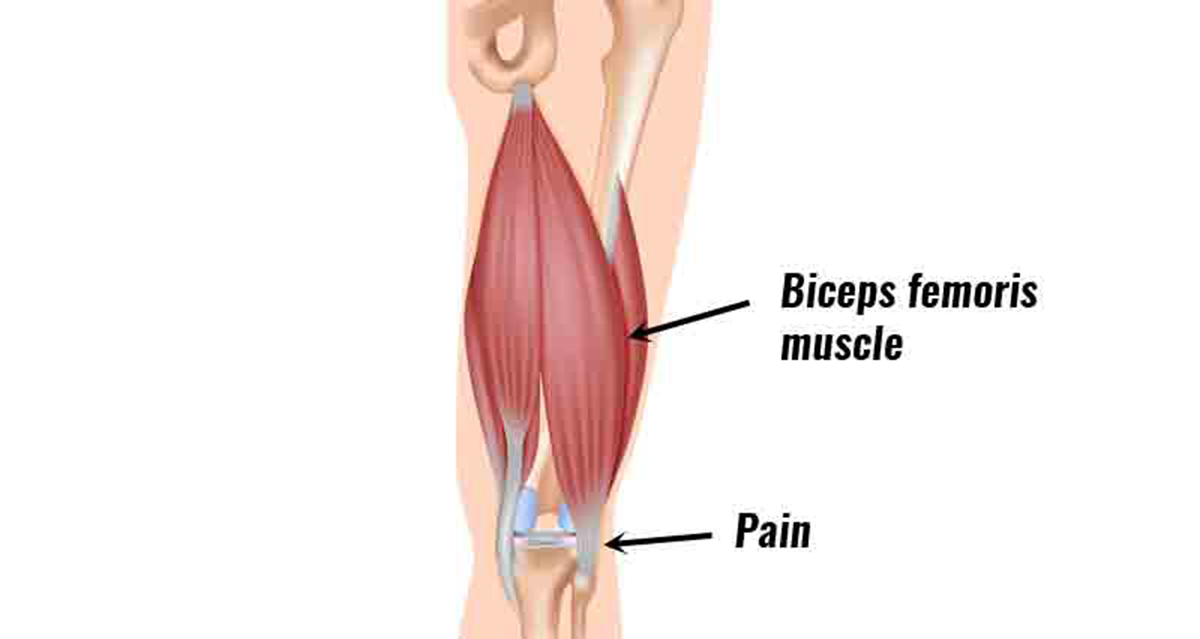 hamstring tendonitis