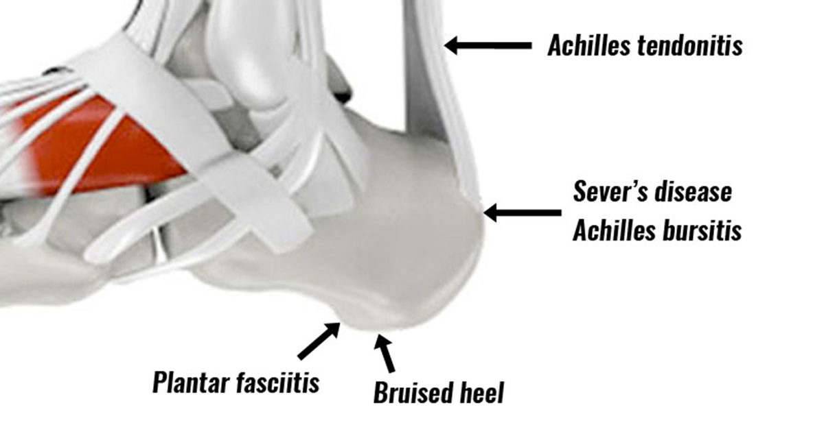 Help for Heel Pain: Affiliated Foot & Ankle Care: Podiatrists